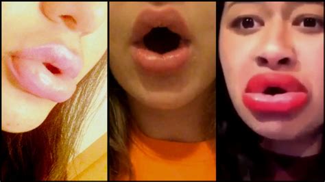 When The Kylie Jenner Lip Transformation Challenge Goes Wrong. Epic Fails!