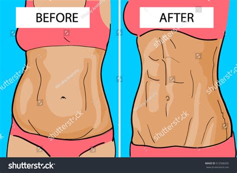 Weight Loss Before After Stock Vector (Royalty Free) 512568205 ...