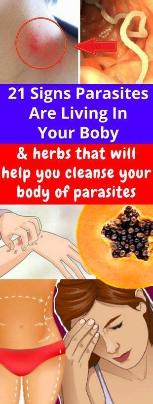 Parasite infections can be treated with the help of various herbs. The ...