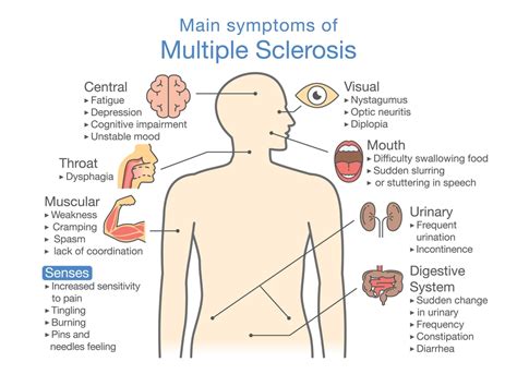 Ayurvedic Treatment for Multiple Sclerosis - Multiple Sclerosis ...