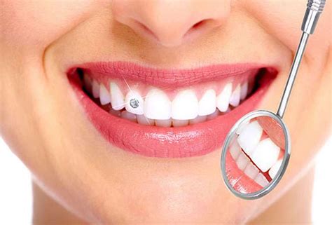 Why Should I Get Teeth Jewellery? | Blue Tooth Dental