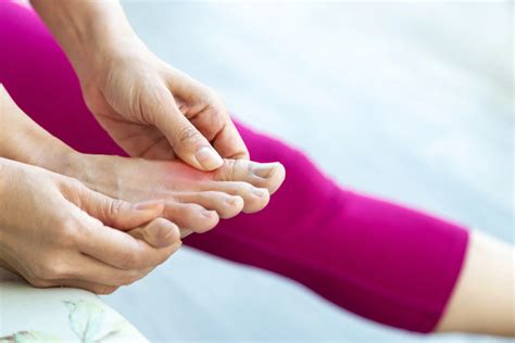 Gout Flare-Ups: Causes and Treatments | LifeMD