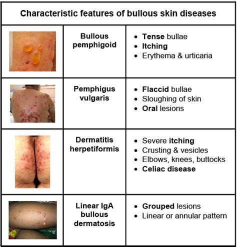 Pin on Dermatology