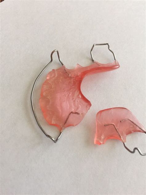 Plastic Retainer Broke In Half - Art & Bussines