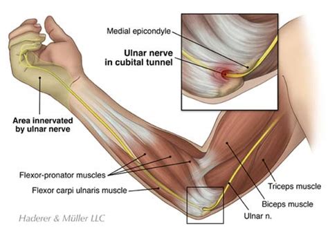 Patient Education Article - Columbia Orthopaedic Group - Patient Education