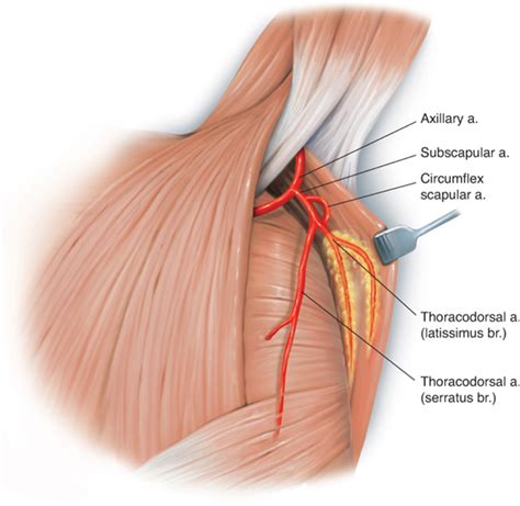 Thoracodorsal Nerve Latissimus Dorsi