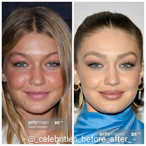 @_celebrities_before_after_ on Instagram: “Gigi Hadid before and after. I think that Gigi's ...