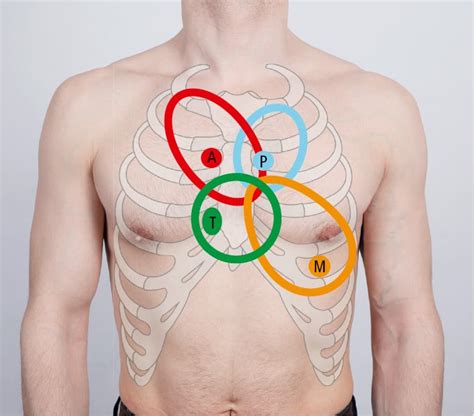 Heart Auscultation - Signs and Symptoms - McMaster Textbook of Internal ...