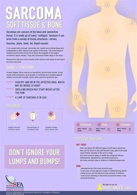 Sarcoma | Sarcoma cancer | Pinterest