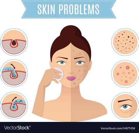 Skin problem solving acne treatment and cleansing Vector Image