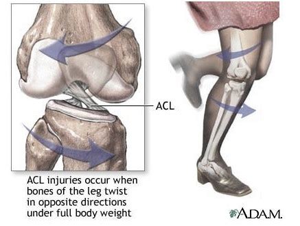 HOW IS A PCL INJURY DIFFERENT FROM AN ACL INJURY? - Get Back To Sport