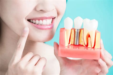 6 Common Myths and Misconceptions About Dental Implants - vlicc.com