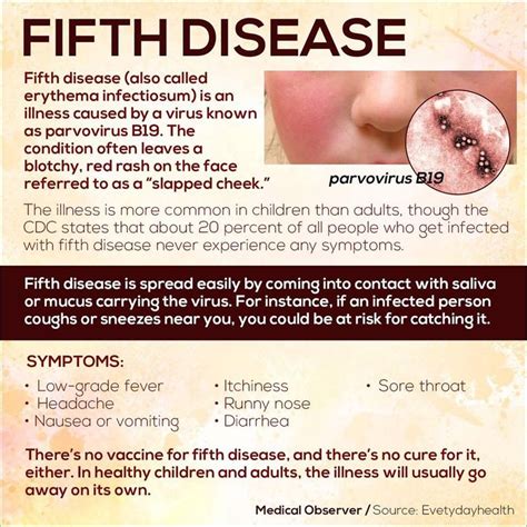 1000+ images about Fifth's Disease on Pinterest | Immune system, A child and Medical