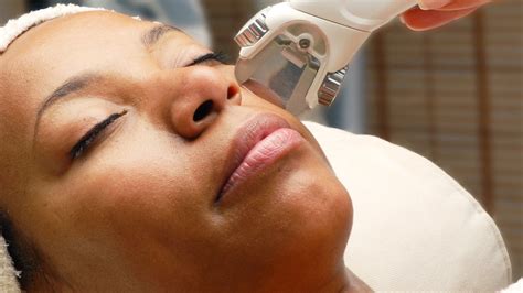 The Best Laser Treatments for Dark Skin | Allure