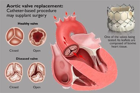 Dr Varuna Varma M.Ch Cardiovascular Thoracic Surgery