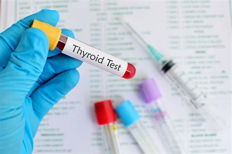 Causes & Health Risks Associated With High T3 Levels - SelfDecode Labs