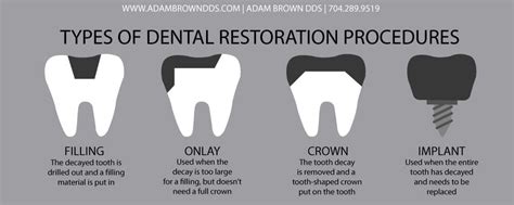 Restotative Dentistry Monroe NC - Adam Brown DDS