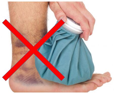 Stop Icing - Impact Rehab & Wellness