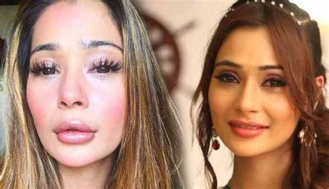 Sara Khan lip surgery gone wrong? Here’s what Ex-Bigg Boss contestant ...