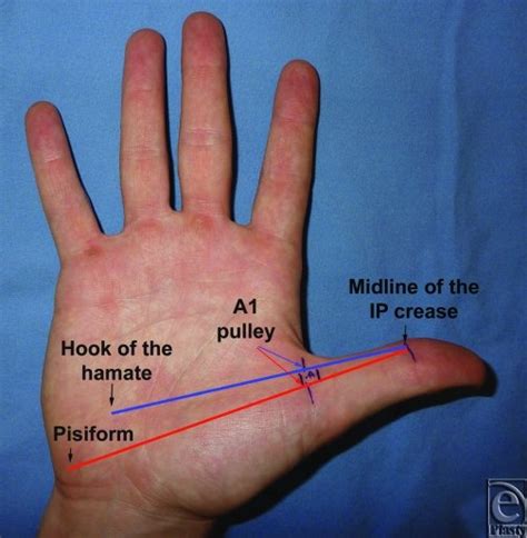 Thumb Anatomy Diagram - vrogue.co