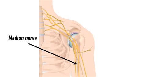 Anterior Interosseous Syndrome - Symptoms, Causes & Treatment