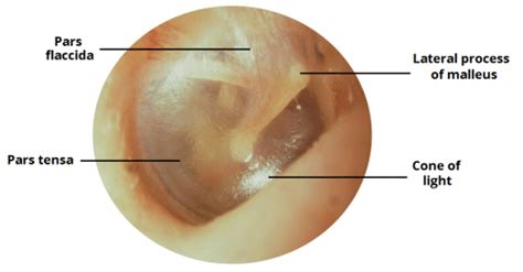 Examination of the Ear - Tympanic Membrane - Hearing Tests - TeachMeSurgery