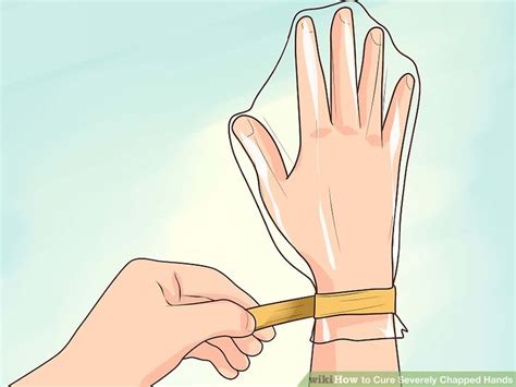 How to Cure Severely Chapped Hands: 5 Steps (with Pictures)