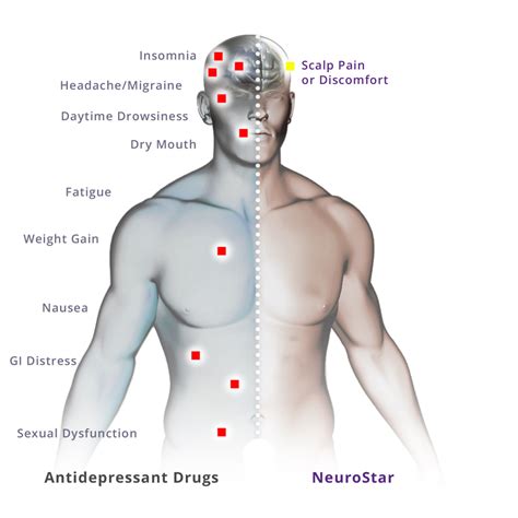 NeuroStar TMS Therapy - Side Effects and Safety Profile | NeuroStar