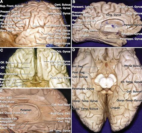 Identification of Sulci and Gyri | Neuroanatomy | The Neurosurgical Atlas