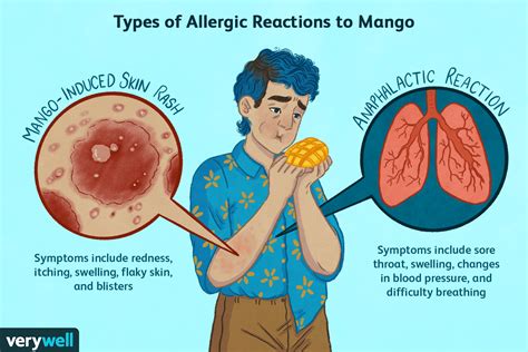 Mango-Allergie: Symptome, Ursachen, Diagnose, Behandlung