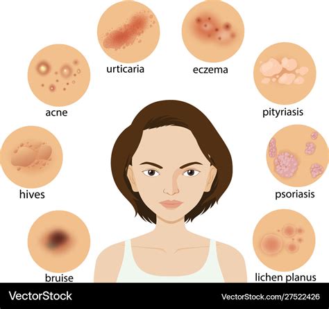 Diagram showing different skin conditions Vector Image