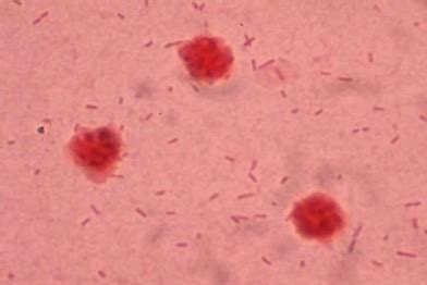 Proteus Morganii Gram Stain