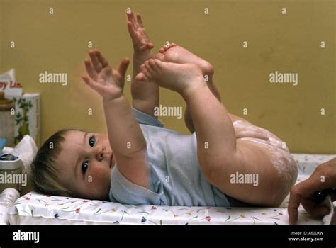 Diaper rash hi-res stock photography and images - Alamy