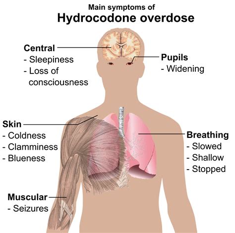 File:Main symptoms of Hydrocodone overdose.png
