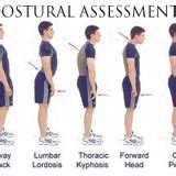 Postural Assessment ( Visual Observation )