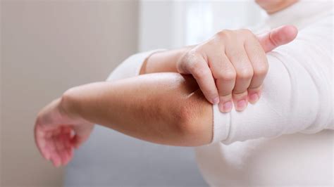 Common Symptoms of a Sprained Elbow | BenchMark Physical Therapy