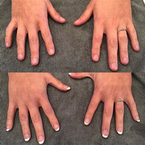 Shellac Manicure Before And After