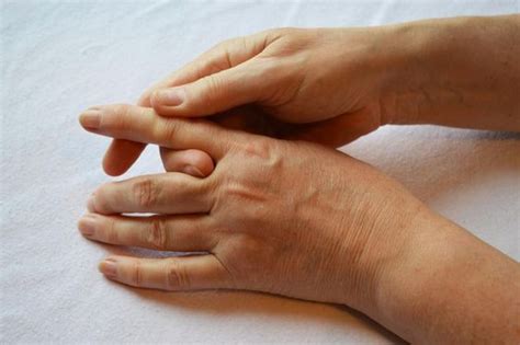 Treatments For Locking Finger Joints - EsHealthTips