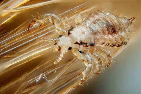 File:Male human head louse.jpg - Wikipedia