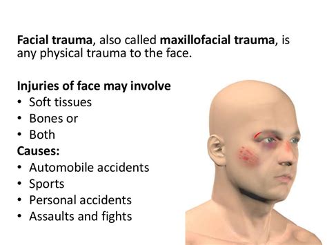 Facial trauma