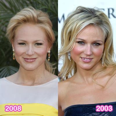 Jewel Plastic Surgery Before and After Breast Implants | Plastic Surgery