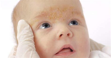 Rash on a baby's face: Pictures, causes, and treatments