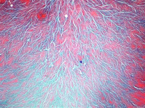 Cytopathology of lymph nodes- FNAC | Cellnetpathology