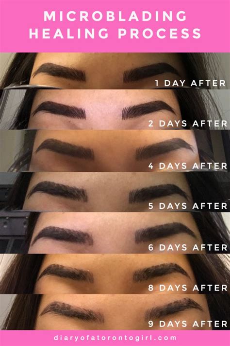 My Microblading Experience (+ Day by Day Healing Photos) | Microblading ...