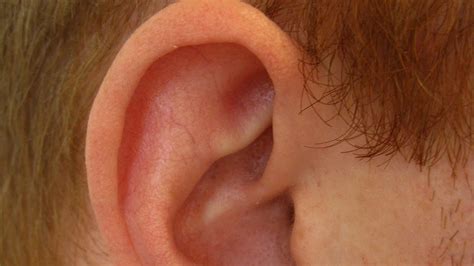 What Is A 'Conch Removal' Procedure, And Why Did This Man Do It To His Ears? Allure | atelier ...