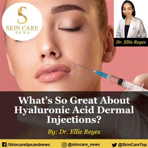 What’s So Great About Hyaluronic Acid Dermal Injections?