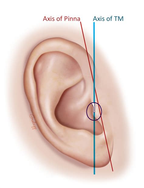 External Ear – Oto Surgery Atlas