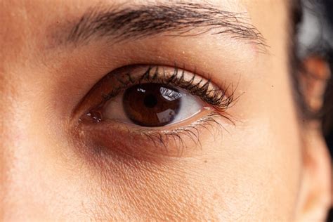 What to Know About Having Brown Eyes - Vision Center