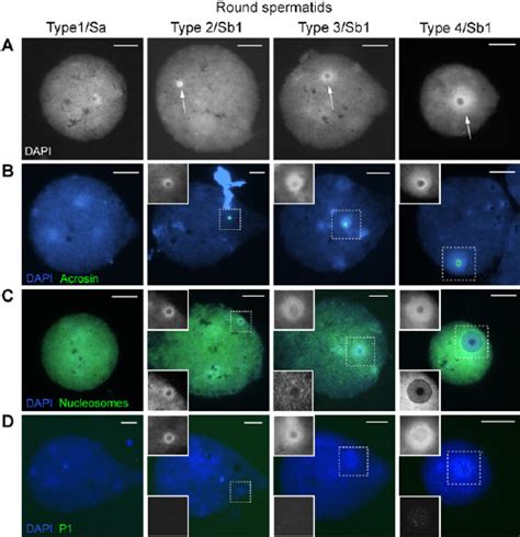 Round spermatid nuclei in succeeding steps of human spermiogenesis ...