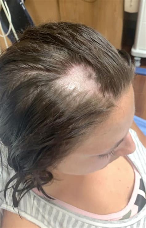 Woman says hair fell out 'in clumps' after using conditioner from Walmart